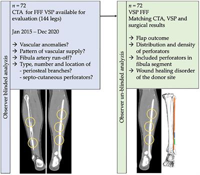 Frontiers | Impact Of Periosteal Branches And Septo-Cutaneous ...